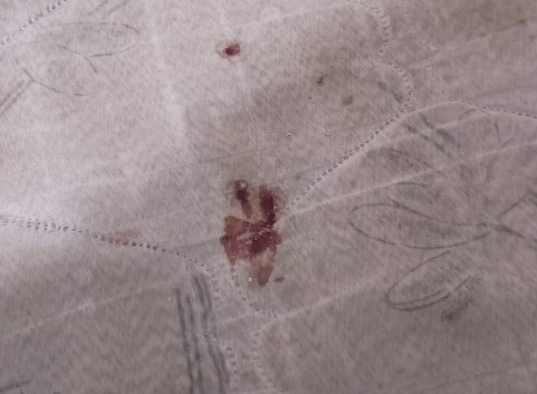 Jovem grávida é atingida por dois tiros dentro de casa em São Cristóvão