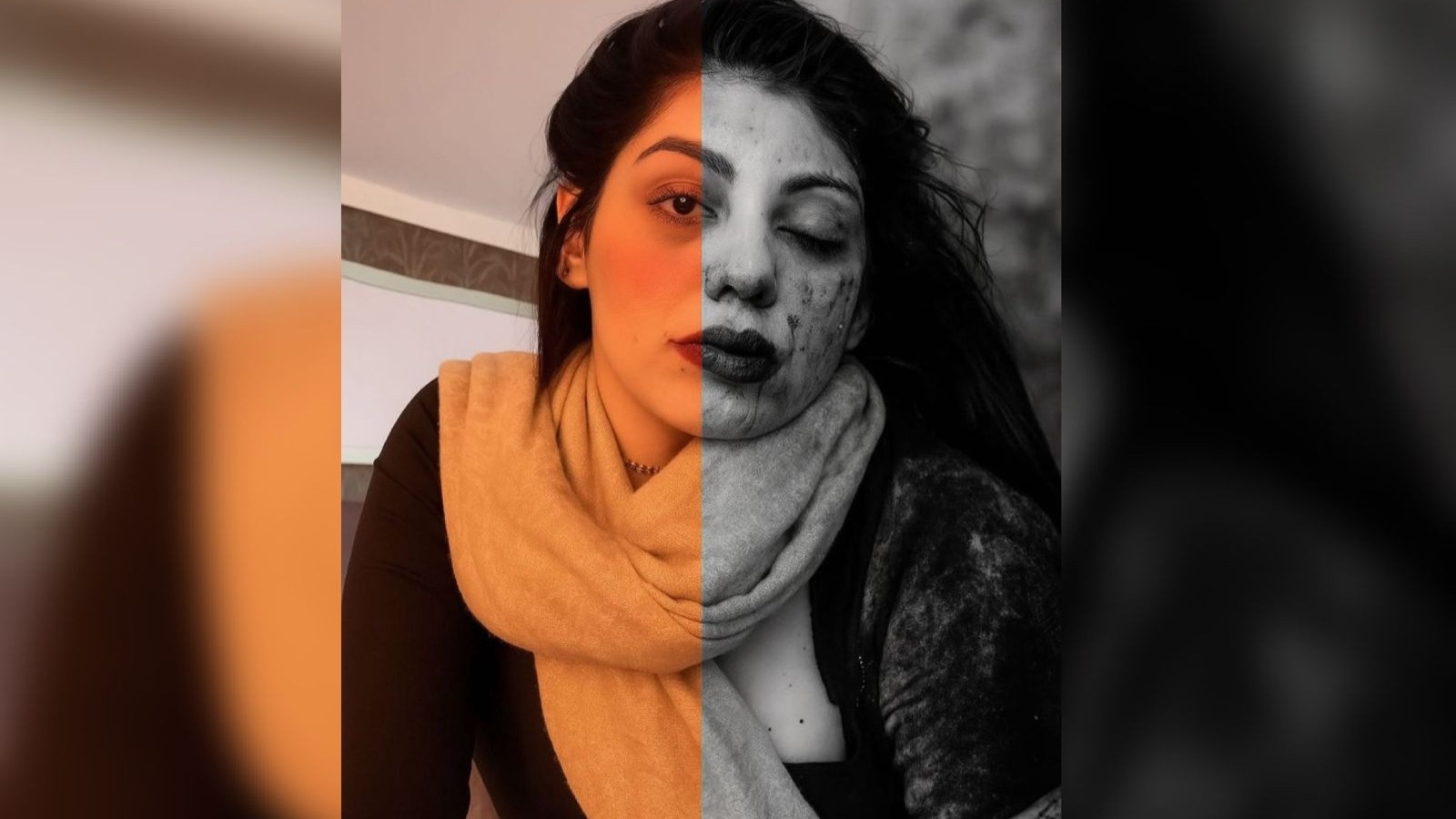 Esposa de lutador posta foto de rosto machucado após agressão do marido: 'Grata por ter sobrevivido'