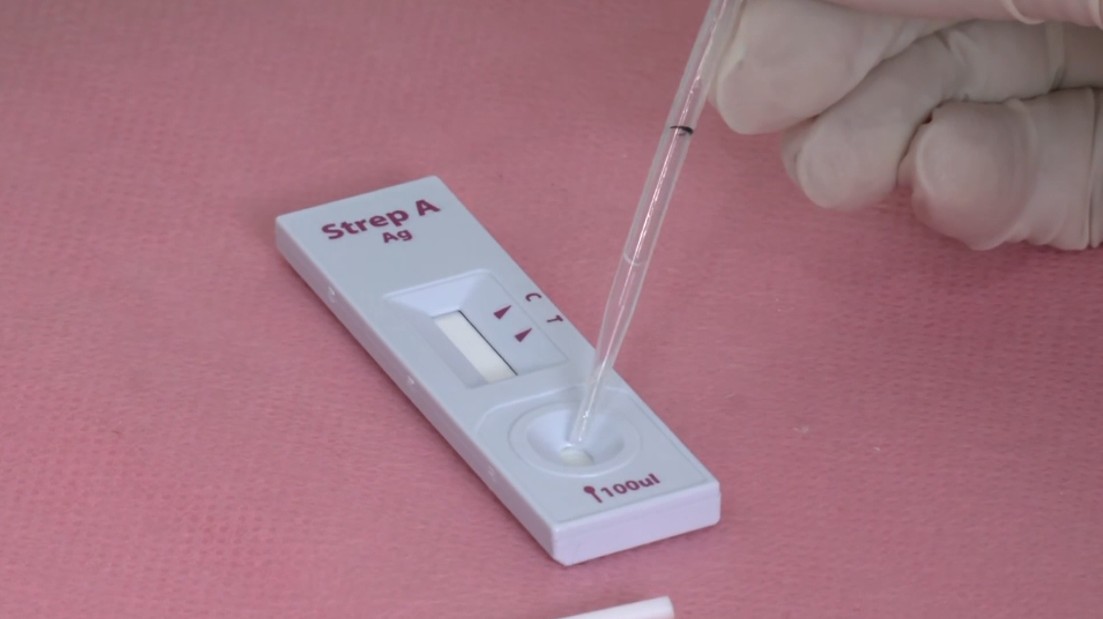 Streptococcus: testes rápidos para detecção da bactéria começam a ser aplicados em São João del Rei