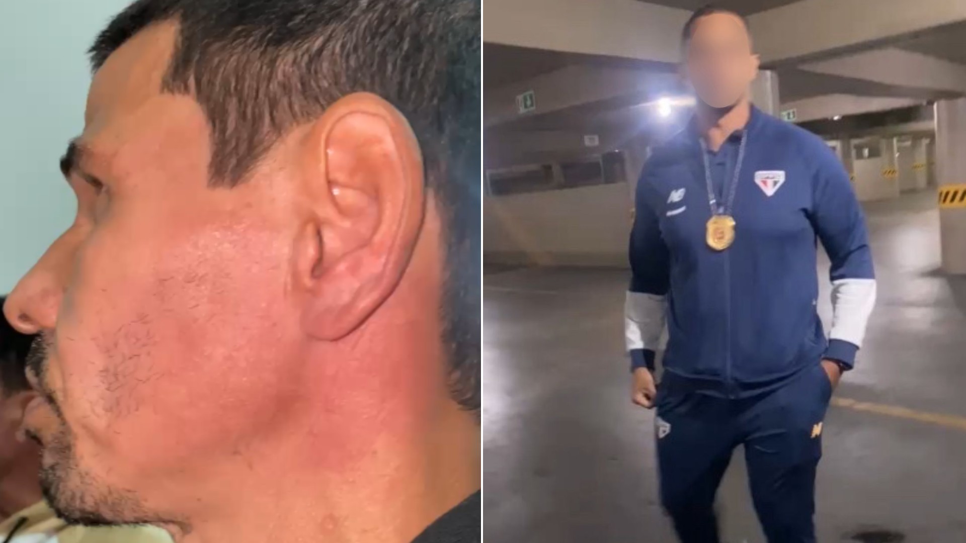 Torcedor do São Paulo diz ter levado tapa no rosto de segurança enquanto tentava foto com Luciano; VÍDEO