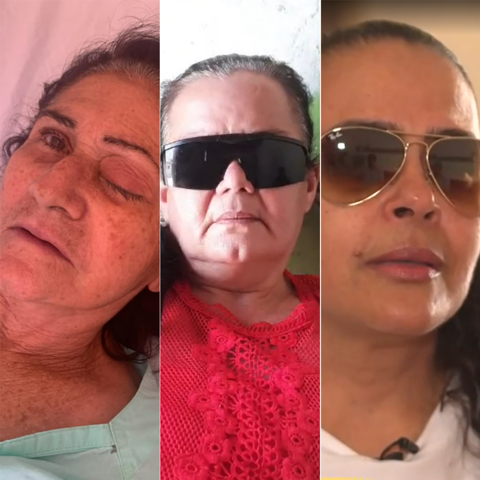 Mutirão de cirurgias de cataratas no RN: quase 6 meses depois, pacientes que perderam globo ocular não receberam indenização