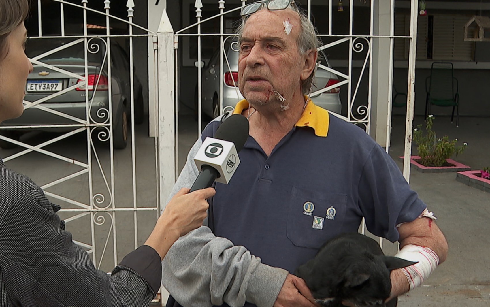 'Não soltava de jeito nenhum', diz idoso ferido em ataque de pitbull em Taquaritinga, SP