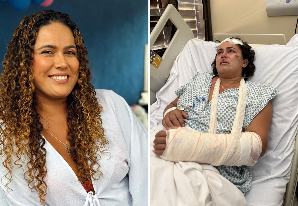 Vítima teve braço e dentes quebrados após ser agredida enquanto dormia  Foto: Arquivo Pessoal/Lorrany Evangelista