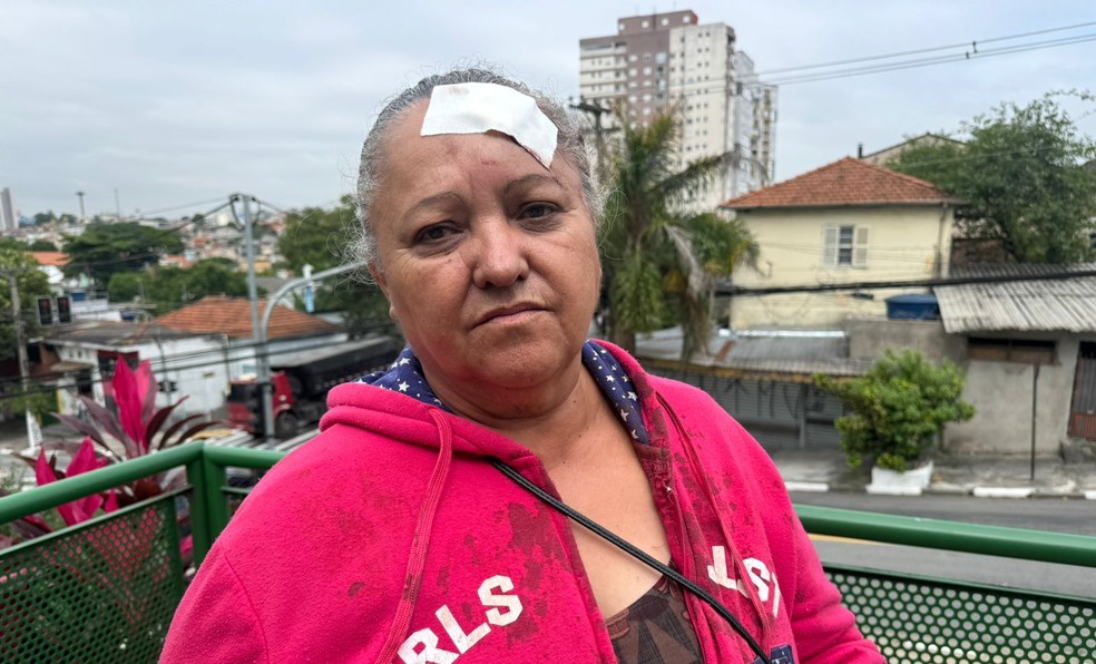 Lenilda foi agredida por policial na garagem de casa e ficou com ferimento na cabeça — Foto: Lucas Jozino/TV Globo