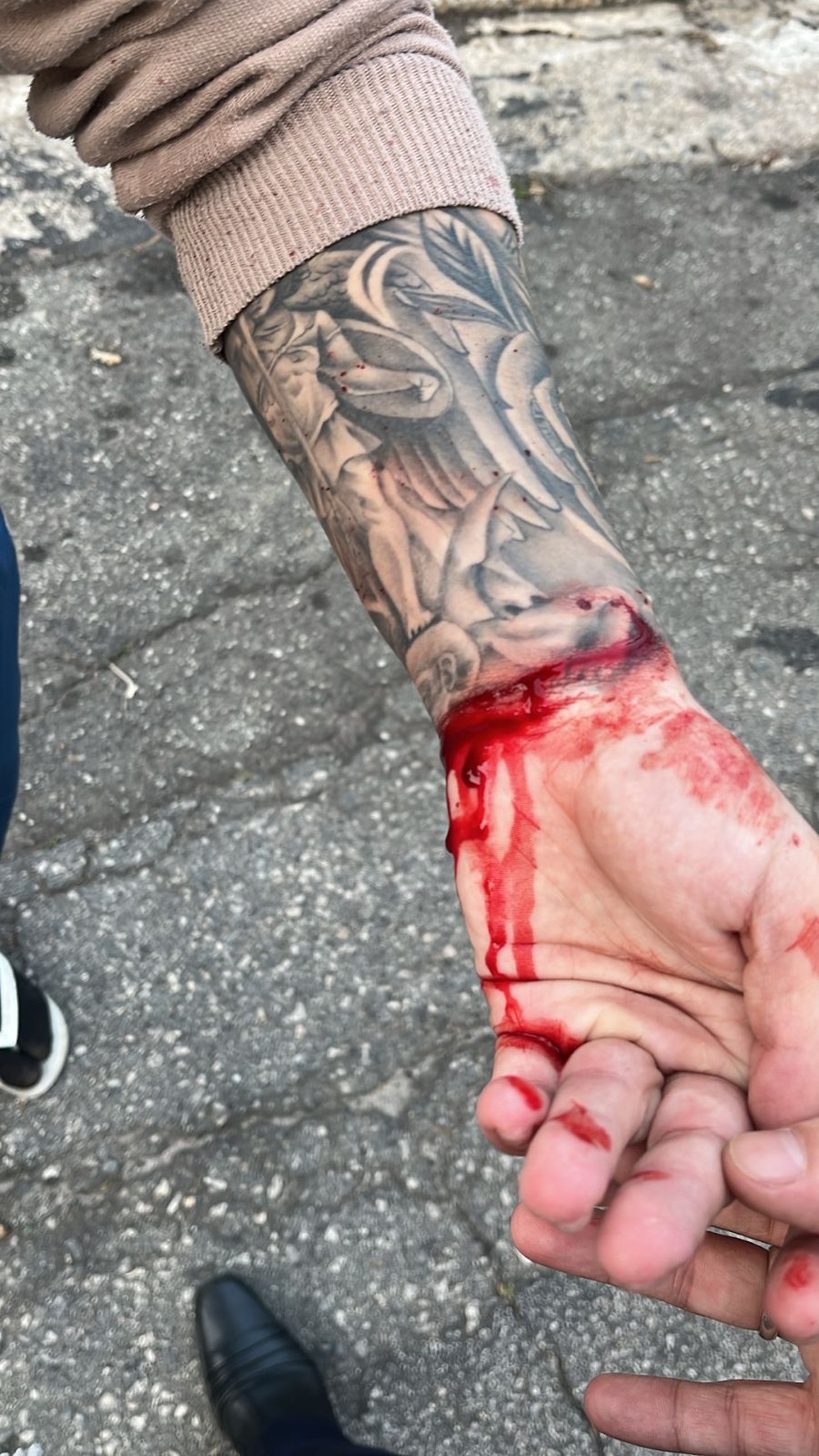 M&atilde;o de jovem foi atingida durante explos&atilde;o no Jaguar&eacute; &mdash; Foto: Arquivo pessoal