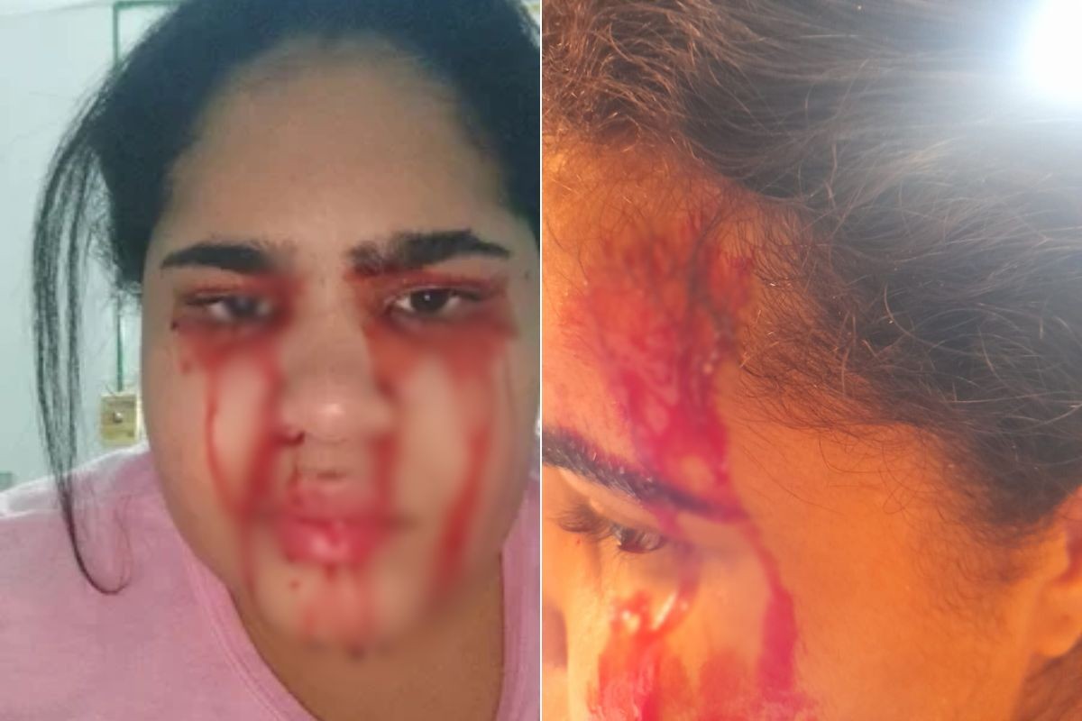 Jovem que sangra pelo nariz, boca, ouvidos e olhos passa a 'suar sangue' e busca tratamento no Nordeste