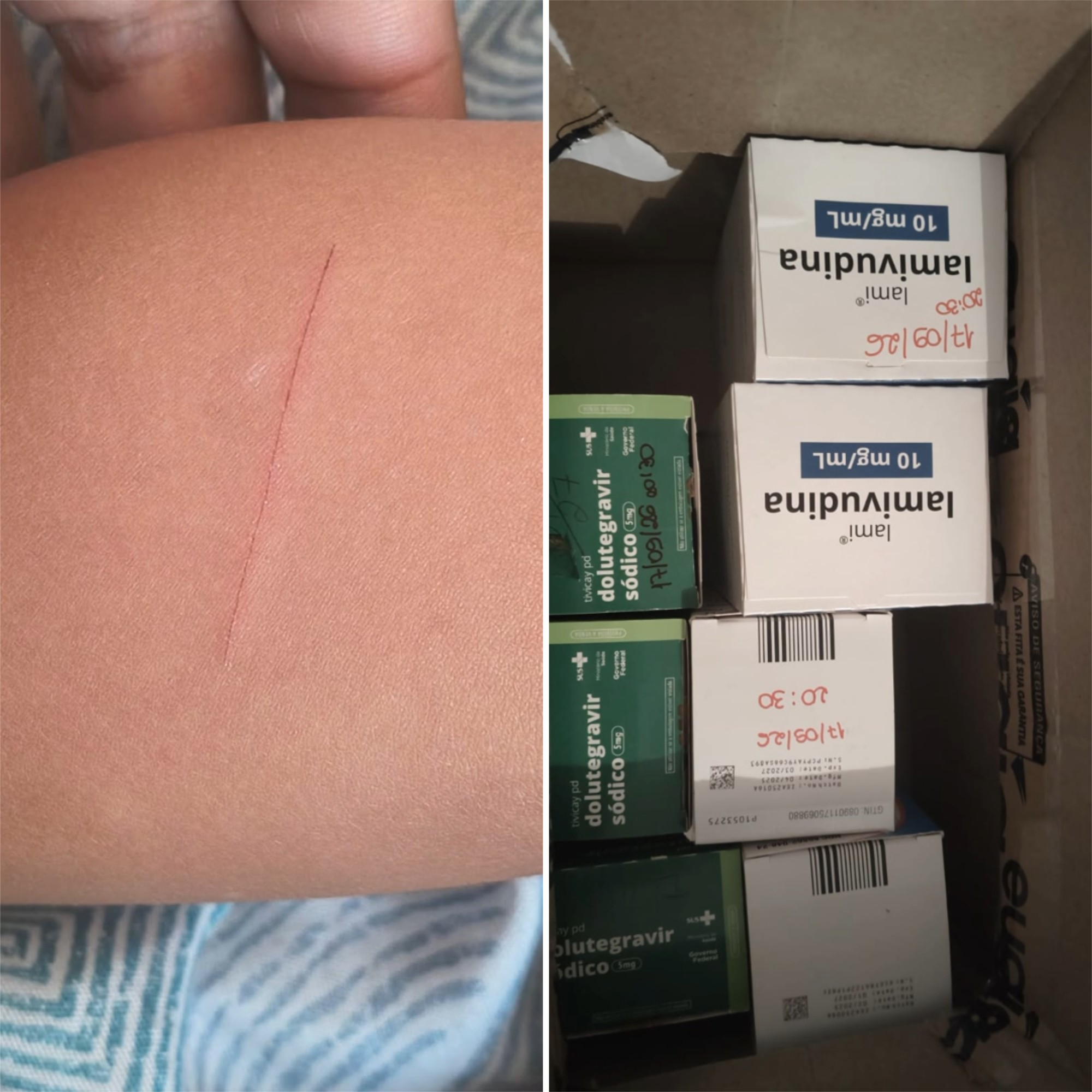 Criança leva navalha para escola e corta colega de 4 anos em Sete Lagoas