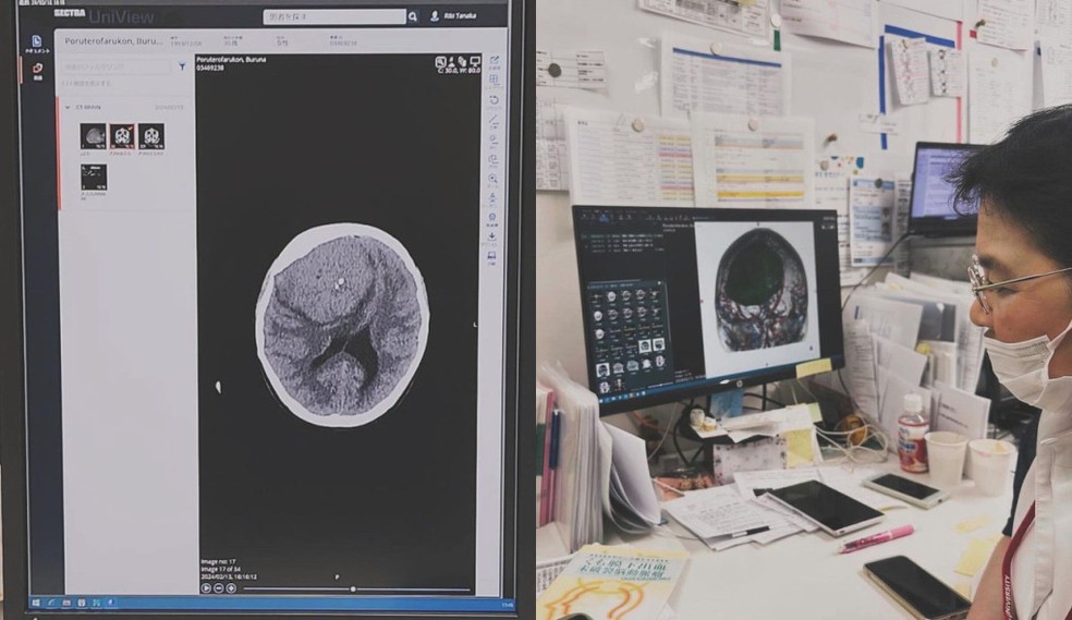A médica Yoko Kato, responsável pelo cuidado de Bruna, explicou que o tumor estaria 'comprimindo' o cérebro da garota — Foto: Reprodução/Redes sociais