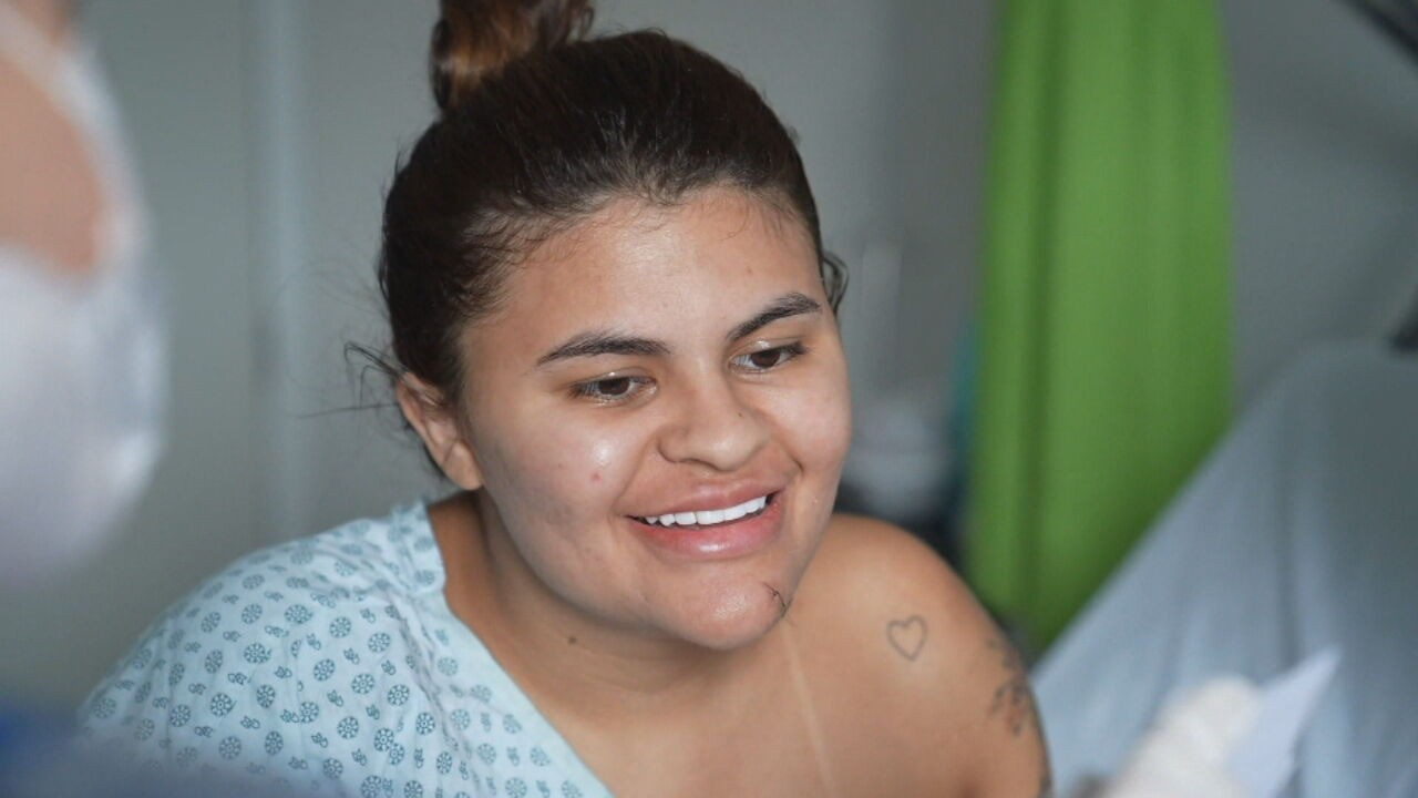 Jovem que teve mãos reimplantadas após ataque de foice começa fisioterapia; namorado e irmão viram réus