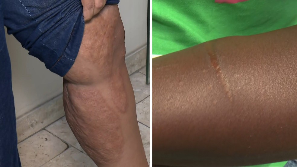 Projeto oferece cirurgias gratuitas a vítimas de violência