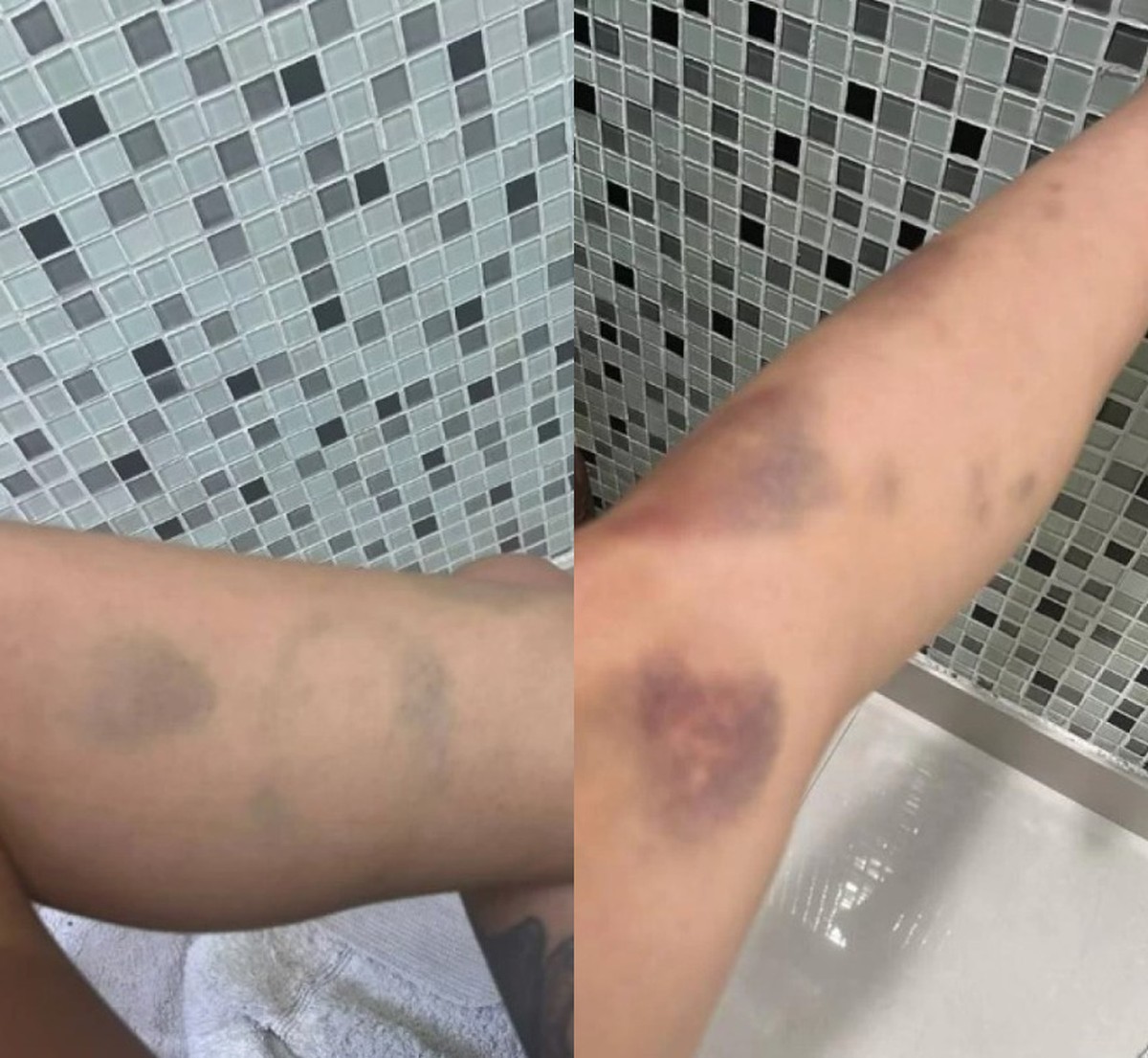 Cantora Tati Zaqui acusa ator Thomaz Costa de violência doméstica com  ameaça de faca e mordidas nas pernas | São Paulo | G1