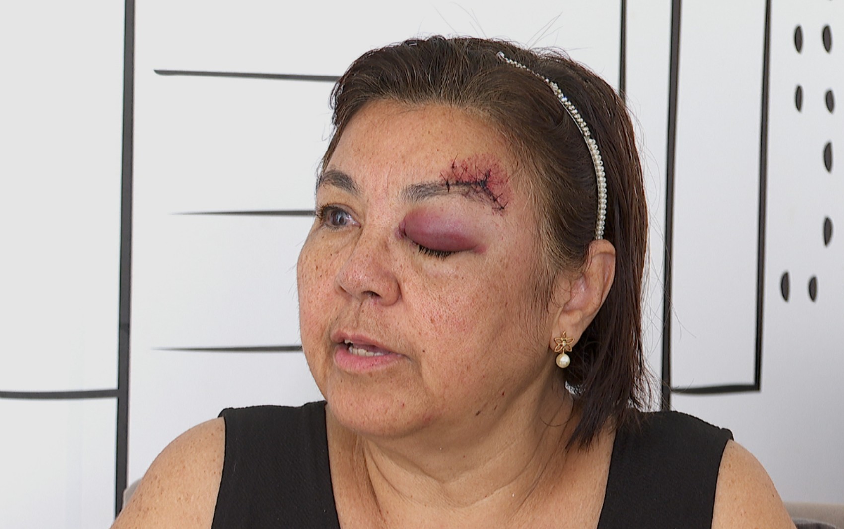 Idosa de 62 anos ferida em ônibus em Ribeirão Preto achou que pedra era tiro: 'Senti pancada e sangue escorrer'