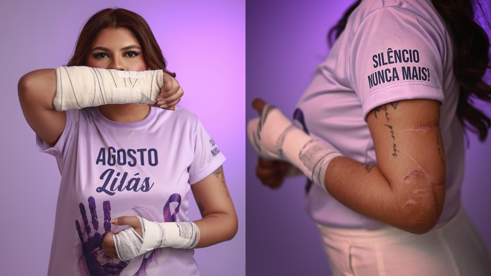 Ana Clara, vítima de tentativa de feminicídio, reflete sobre o caso. — Foto: Imagens cedidas por Bruno Sousa (@brunosousafotografia).