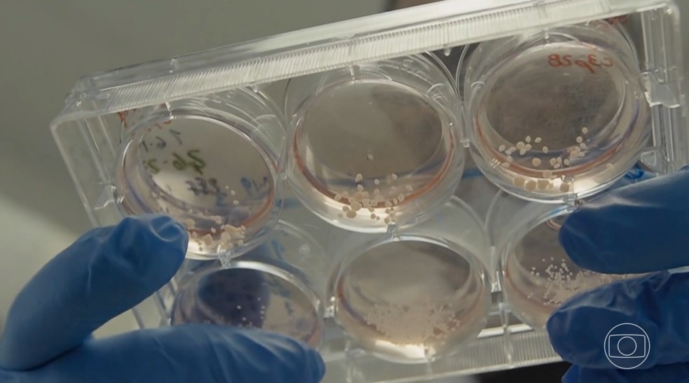 Cérebros humanos se desenvolvem no laboratório da mesma forma que no ventre da mãe — Foto: Reprodução/TV Globo