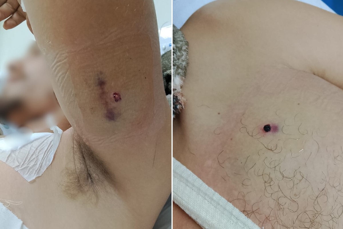 Homem é baleado por ex-chefe na frente da mãe e da esposa em sítio no interior de SP