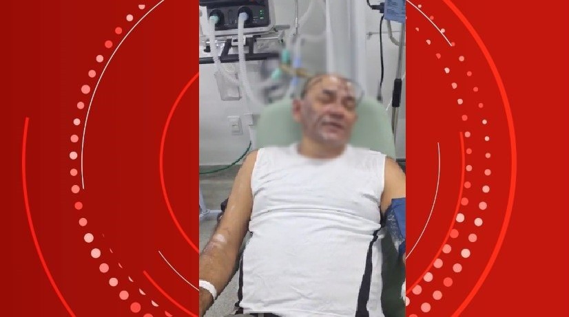 Sargento da PM fica ferido após ser atingido com óleo quente por paciente em surto em Maceió