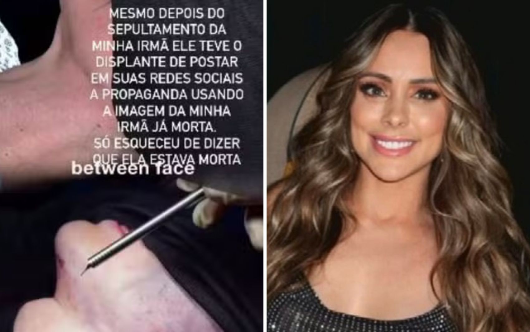 Médico postou imagens de empresária após plástica e manteve foto após a morte dela, diz família