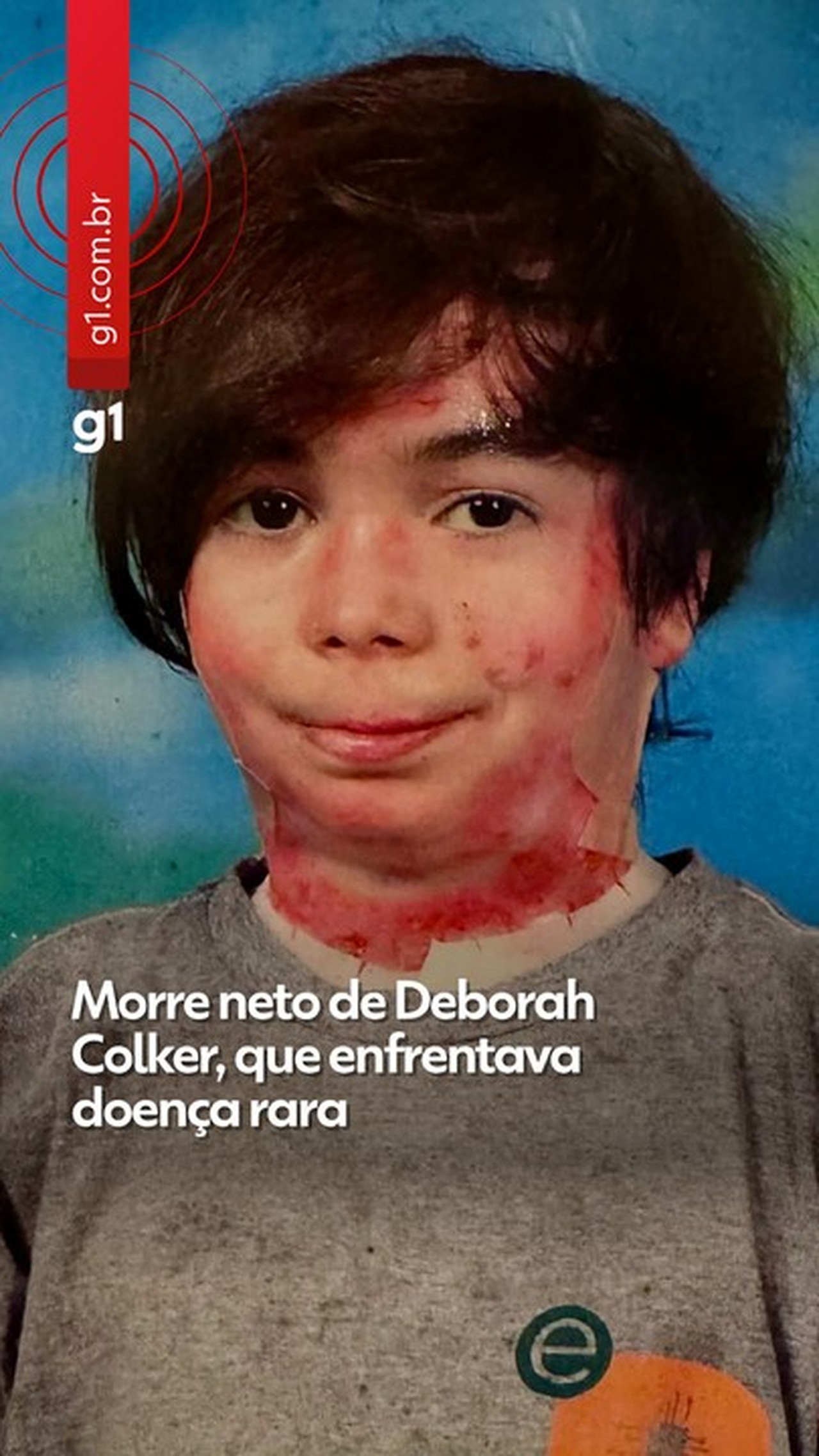 Morre Theo Colker, neto de Deborah Colker, que se tratava de doença rara: ' Guerreiro que se tornou luz'