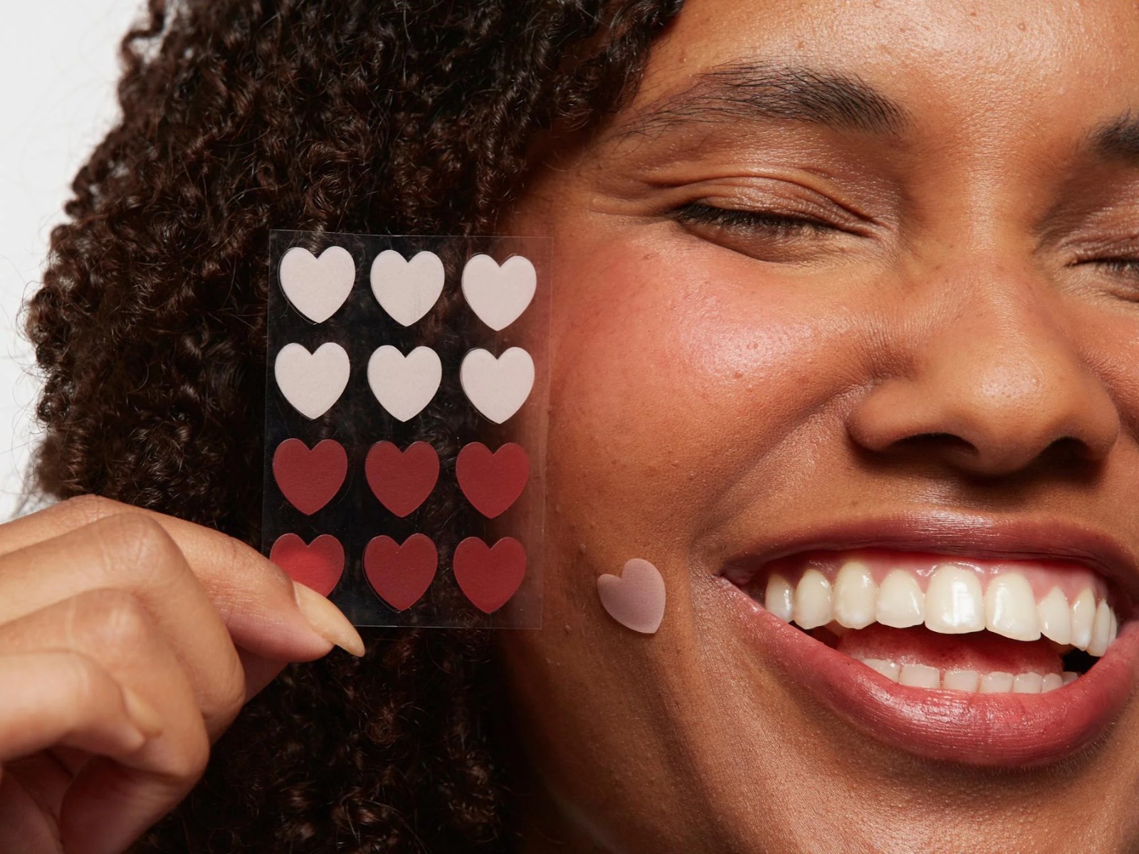 Adesivos para espinhas ajudam a tratar acne? Dermatologista acreana explica