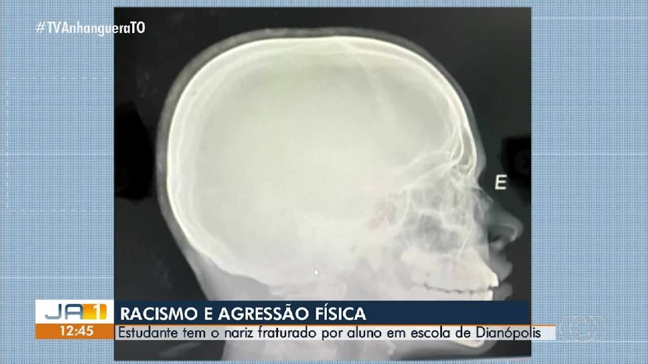 VÍDEOS: Jornal Anhanguera 1ª Edição-TO de quarta-feira, 11 de março de 2026