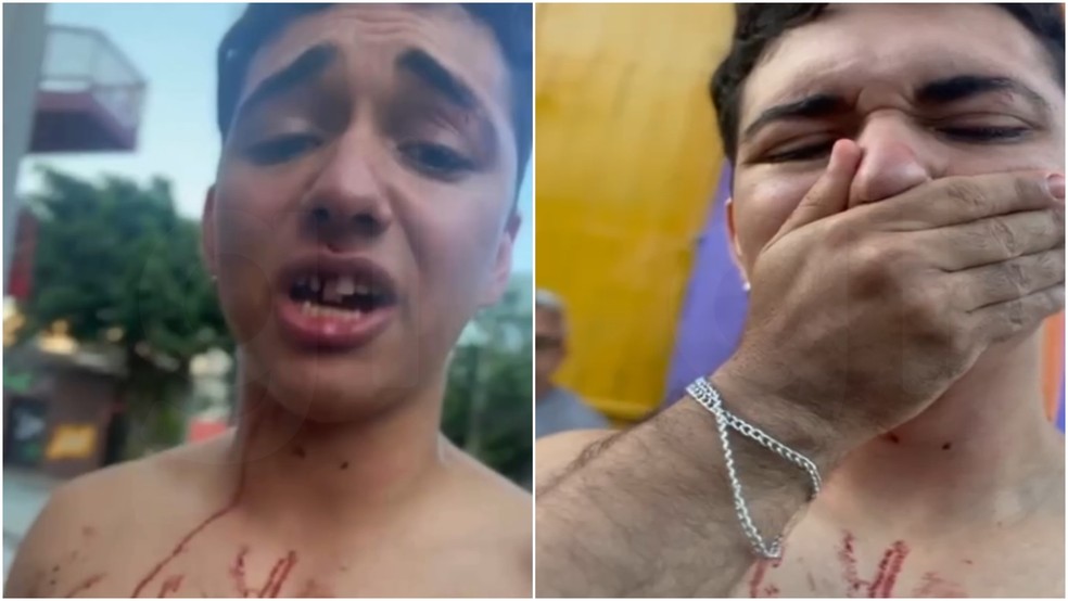 Estudante denuncia ter sido agredido por segurança de festa após passar mal — Foto: Arquivo pessoal