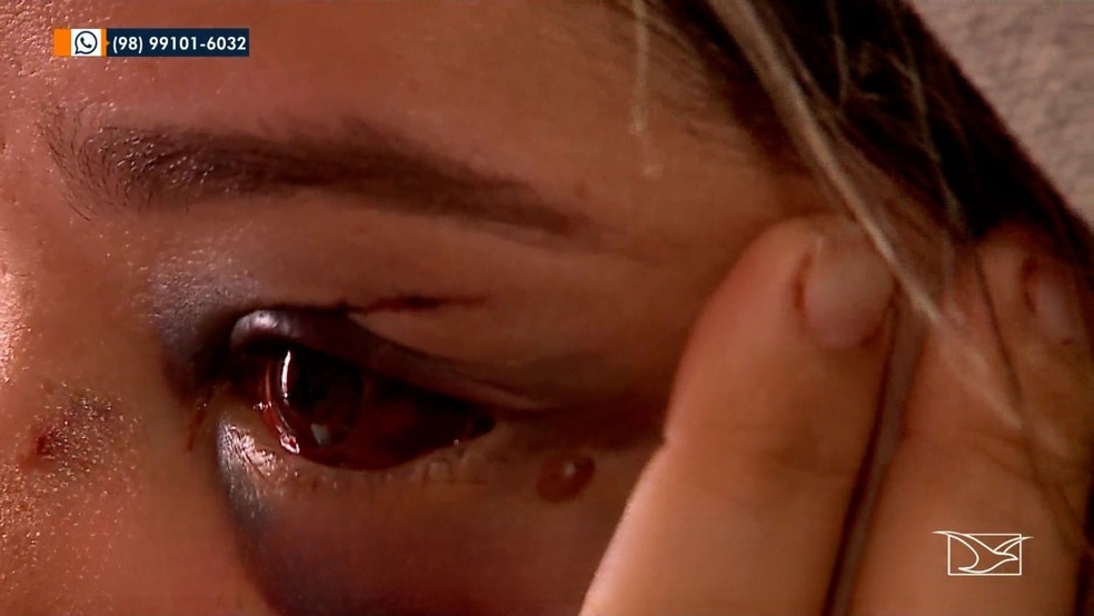 'Eu lutava a todo custo para poder me salvar', diz enfermeira após cair em emboscada do ex-marido em São Luís — Foto: Reprodução/TV Mirante