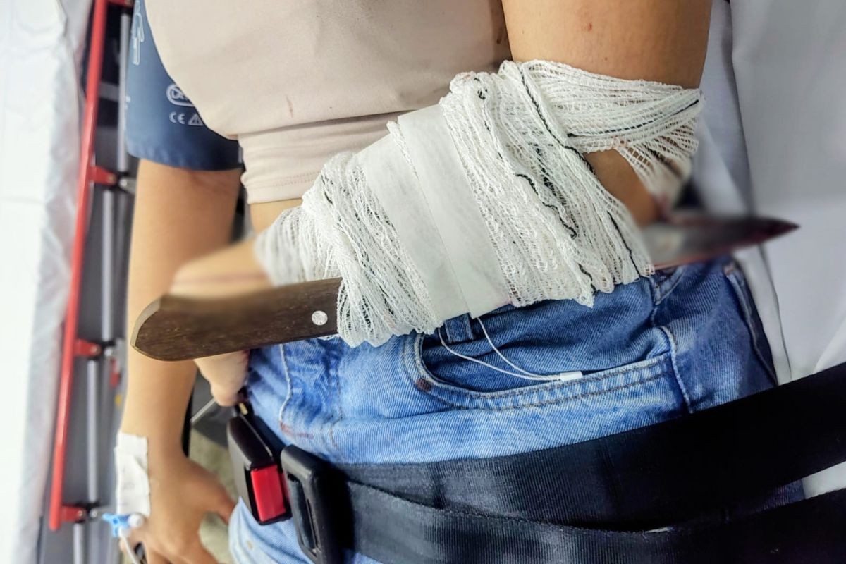 Mulher tem faca cravada no braço durante briga em bar no litoral SP