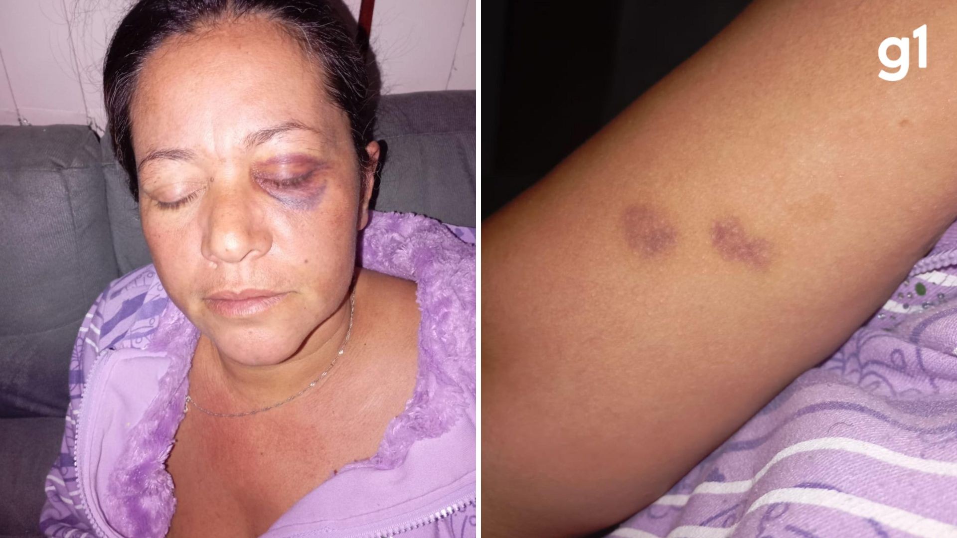 Mulher denuncia agressão de policiais militares durante abordagem no RS; polícia investiga