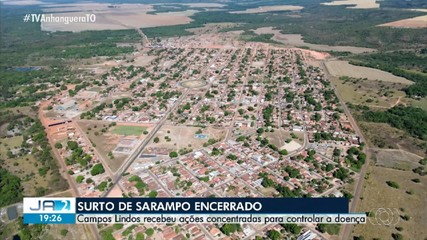 Autoridades declaram fim do surto de sarampo em Campos Lindos