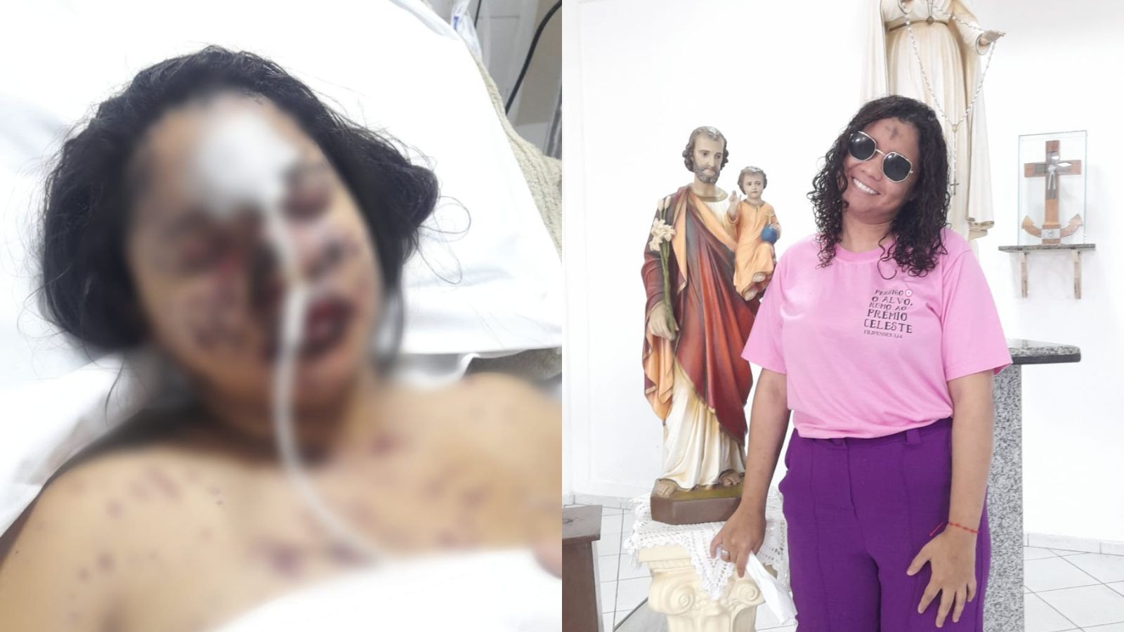 Jovem de 26 anos perde 95% da visão após reação alérgica a remédio e descobre síndrome rara no Piauí 