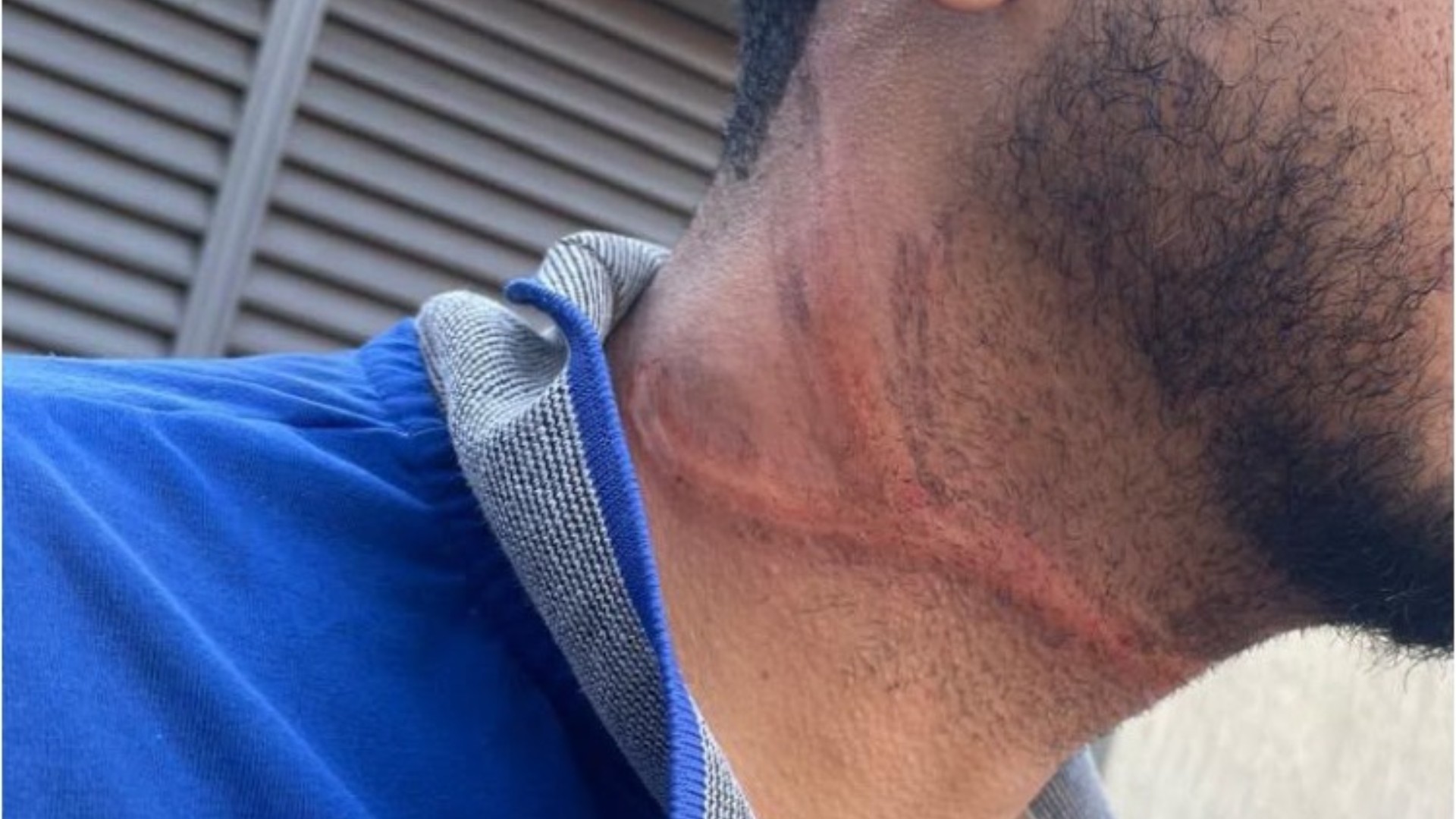 Motociclista cai e tem pescoço ferido por fio de internet solto em MG