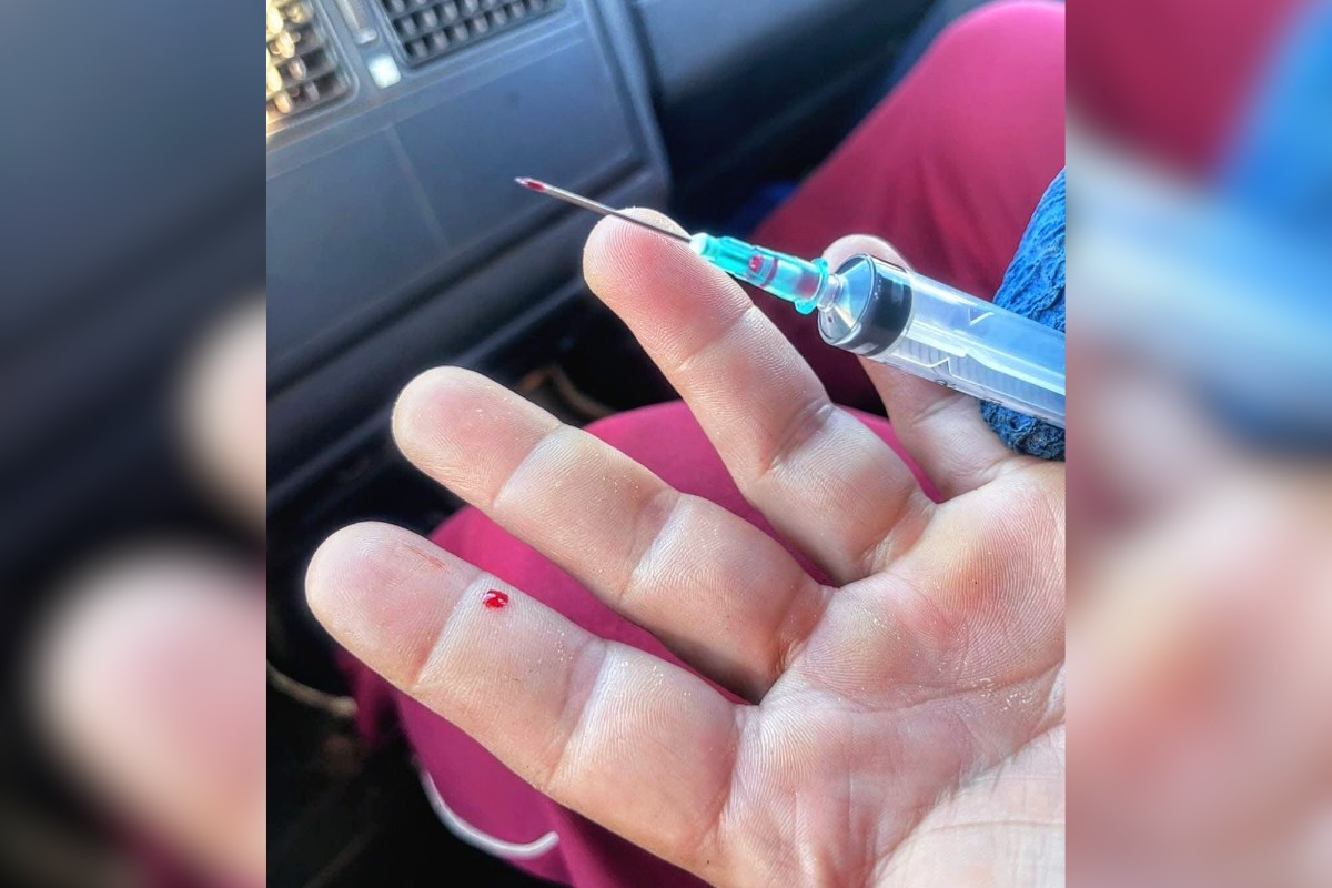Coletor de lixo se fere com seringa descartada em lixo comum em Cerqueira César
