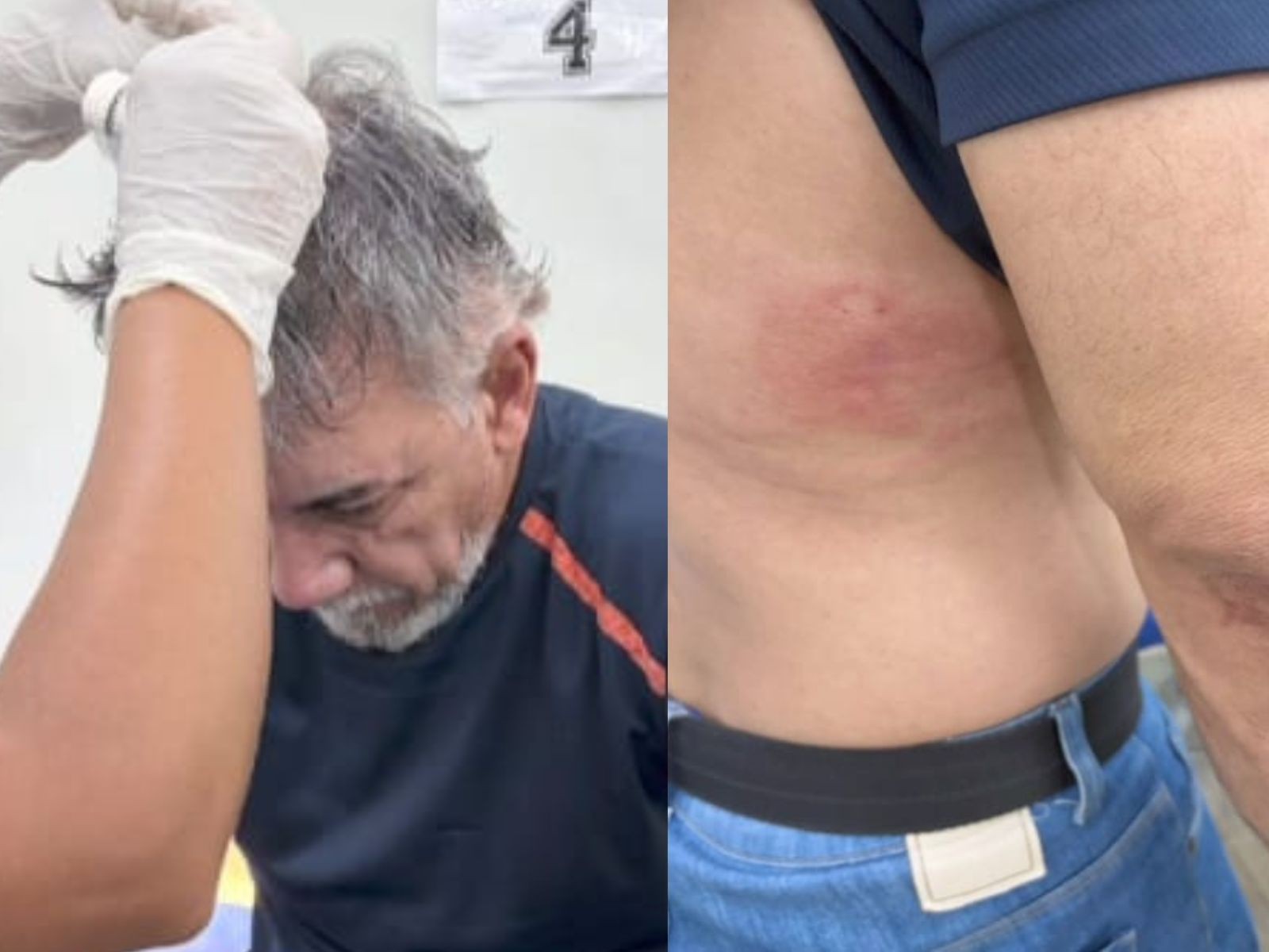 VÍDEO: Jornalista agredido com socos durante assalto no AC diz que já tinha recebido ameaças
