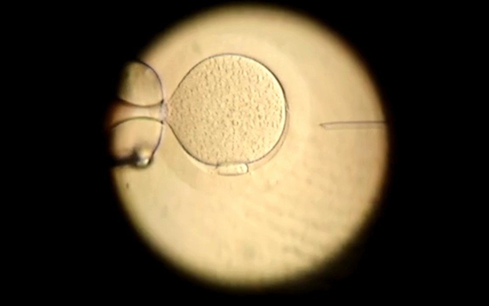 Estudo indica que a maioria das terapias complementares para fertilização in vitro carece de evidências científicas