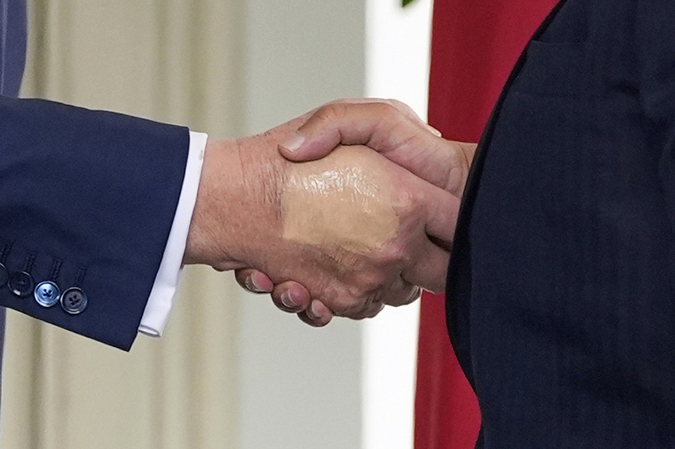 Mão de Trump aparentemente maquiada durante encontro na Casa Branca, em 16 de julho de 2025 — Foto: AP Photo/Alex Brandon