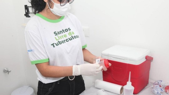 Santos realiza testes de tuberculose até sexta-feira