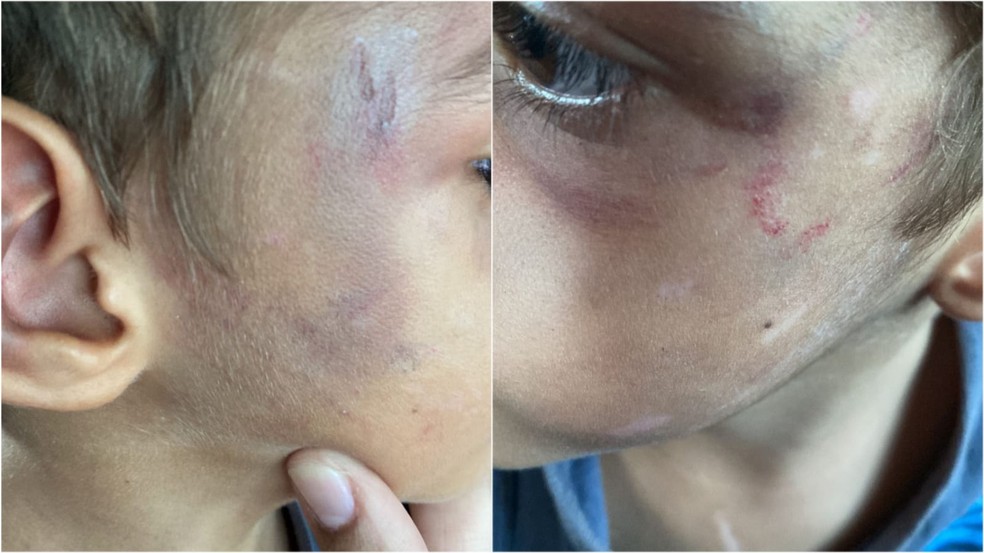 criança espancada vergel maceió — Foto: Divulgação