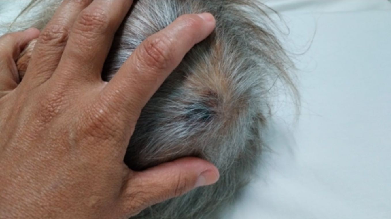 Justiça condena Jaguariúna a pagar internação de idosa em instituição privada após indícios de queda na UTI do hospital municipal