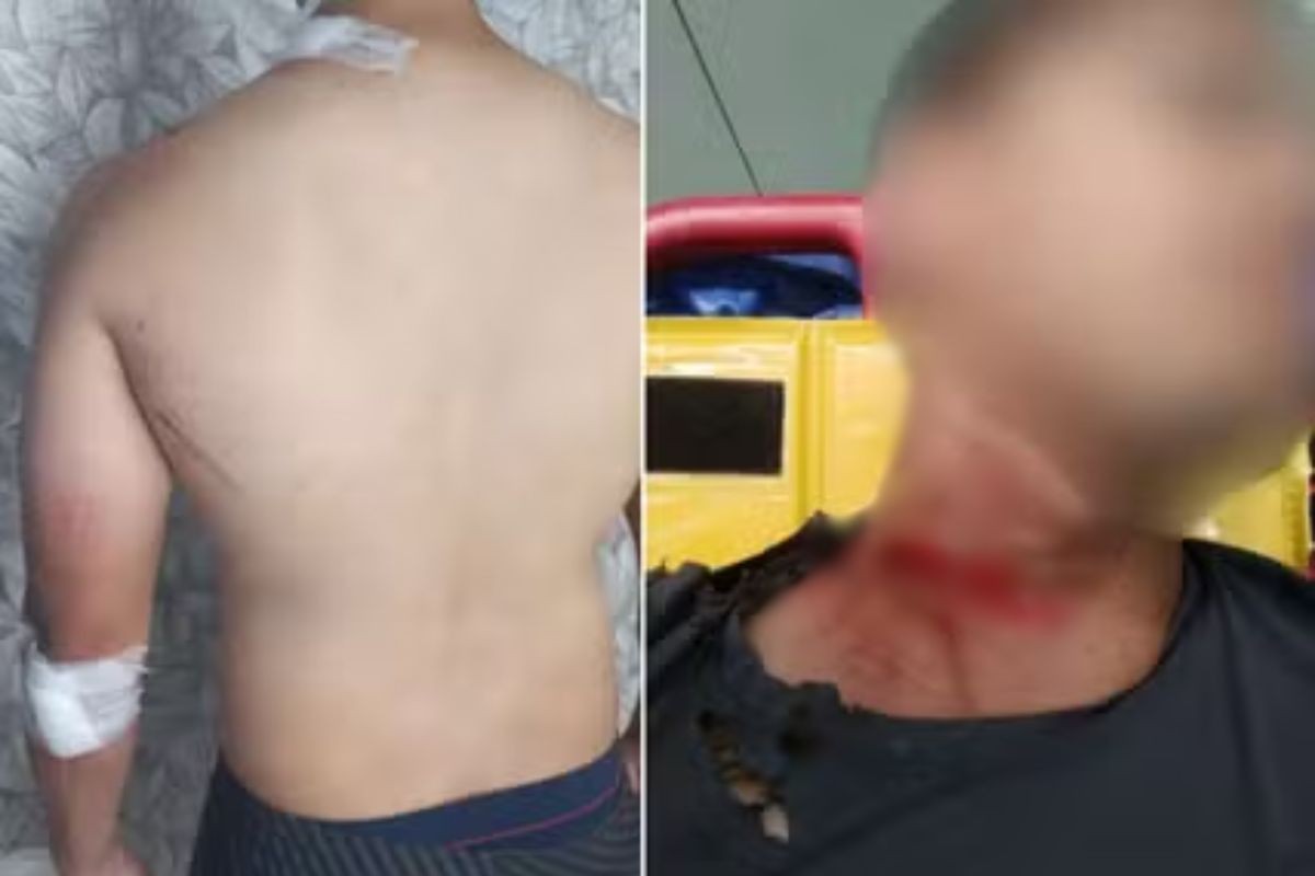 Motociclista que se acidentou após se enroscar em fiação em Santos, SP, será indenizado