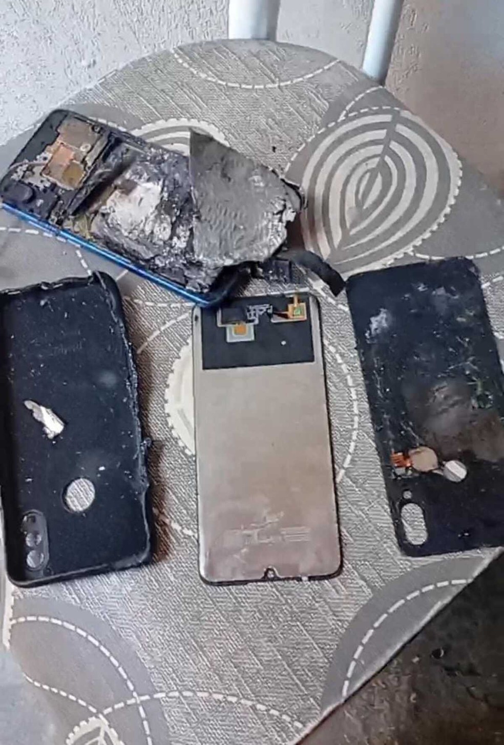Celular incendeia no bolso de menino de 10 anos e provoca queimaduras em Portalegre | Foto: Reprodução
