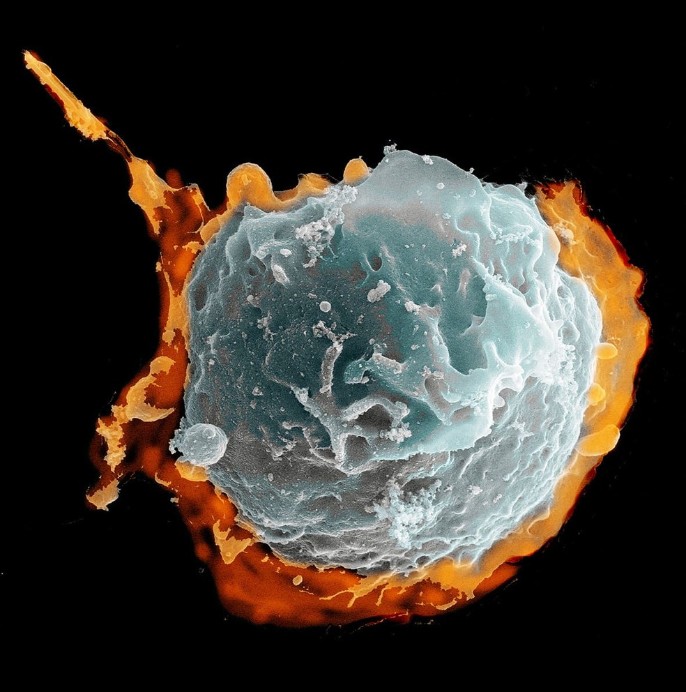  Imagem mostra um leucócito, são células que protegem o organismo de infecções, inflamações, processos alérgicos e parasitas — Foto: Divulgação