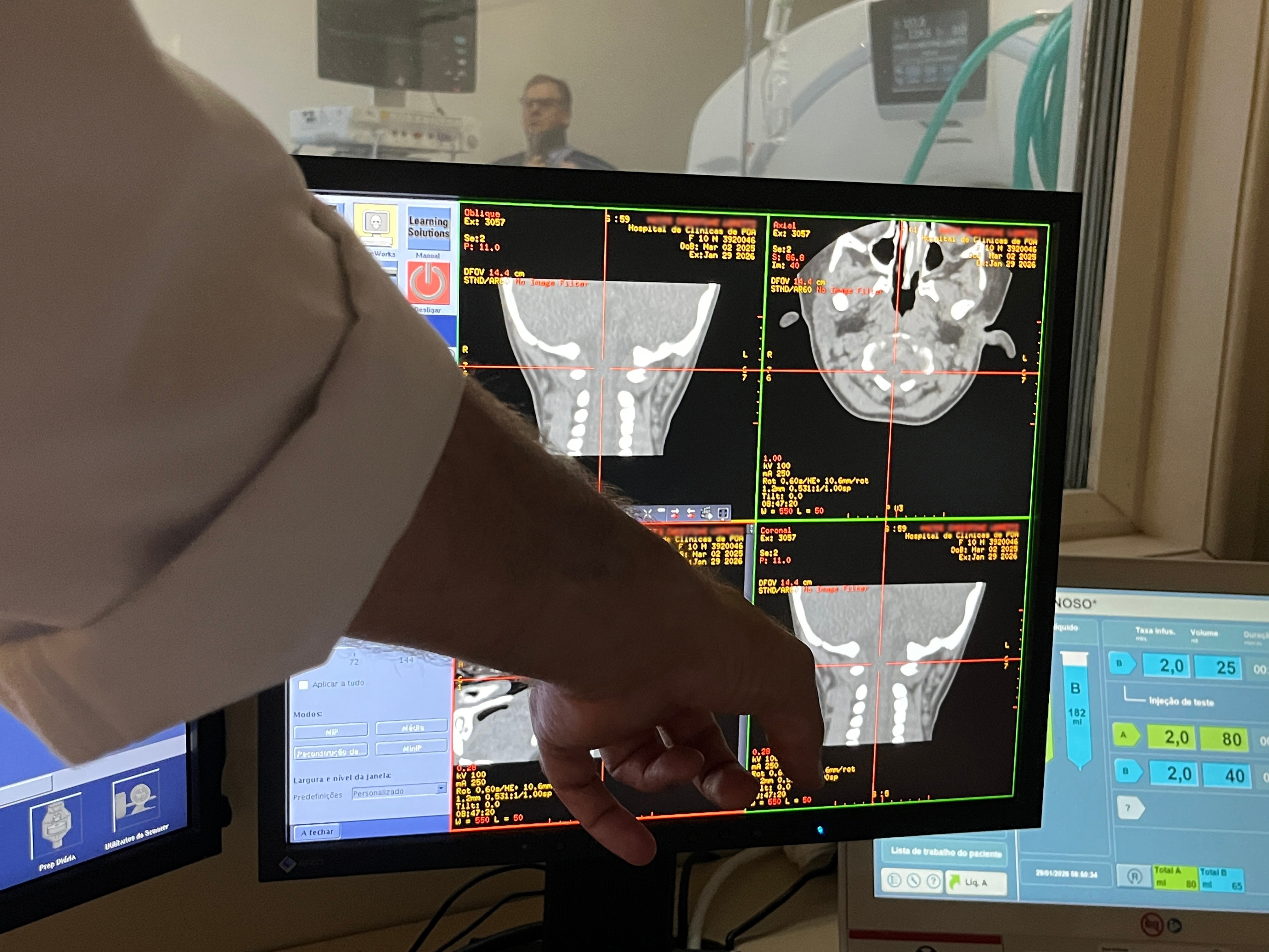 Fiocruz inicia estudos com terapia para Atrofia Muscular Espinhal; custos podem chegar a 25% do valor atual