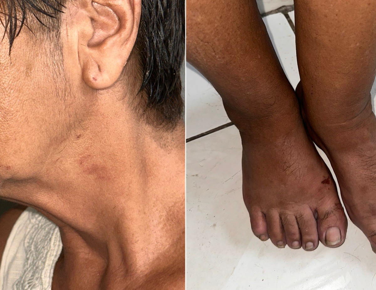 Idosa de 70 anos é vítima de estupro em Cabo Frio após levar uma 'gravata'