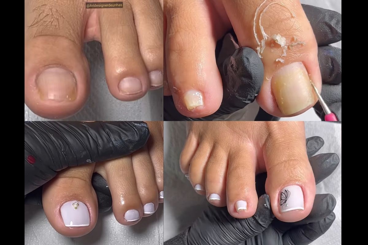 Tirando cutículas, pedicure faz sucesso e tem mais milhões de views: 'satisfatório'