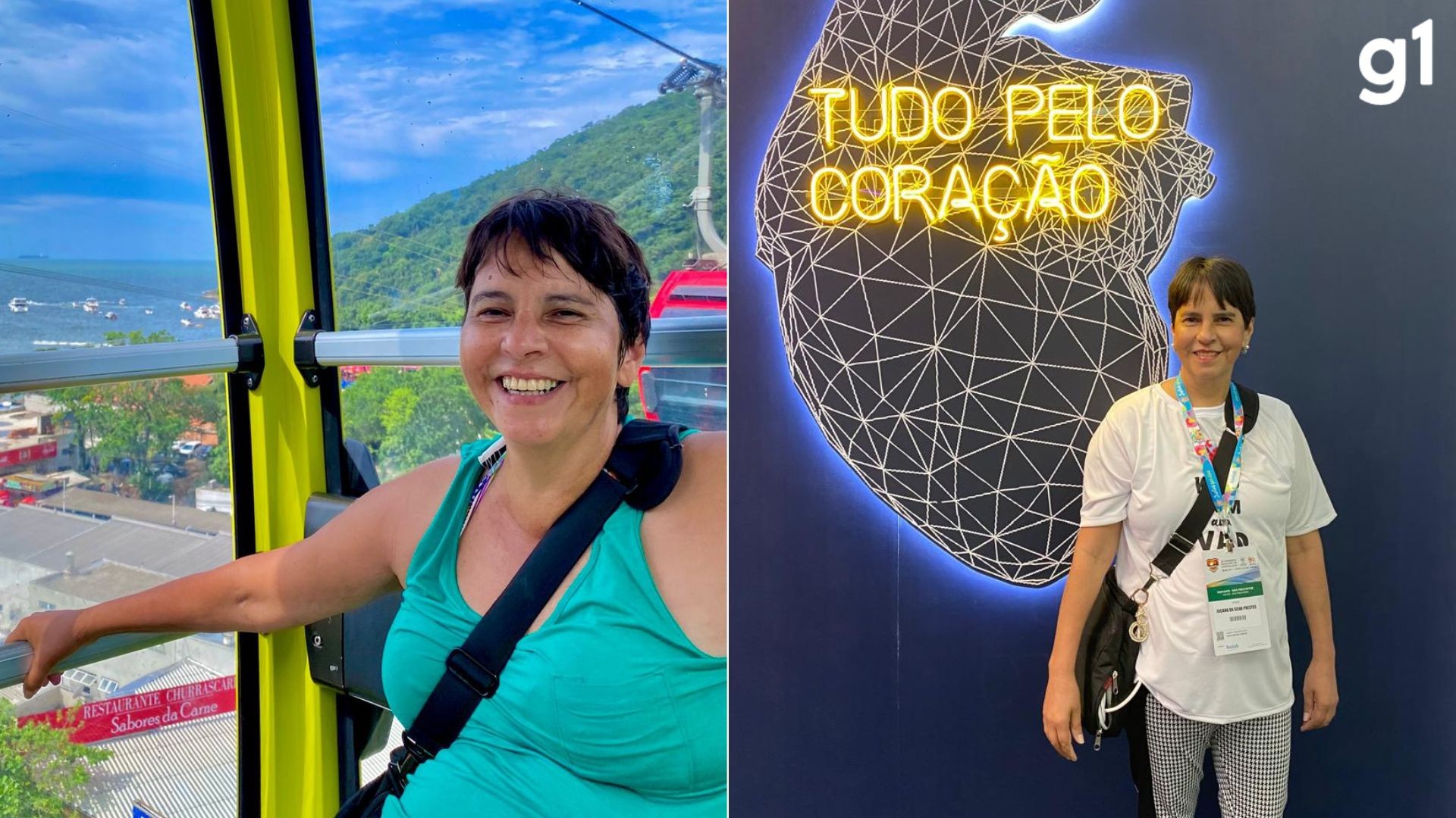 'Coração' na bolsa: mulher que não podia receber transplante vive há 8 anos com aparelho de meio milhão a tiracolo no RS