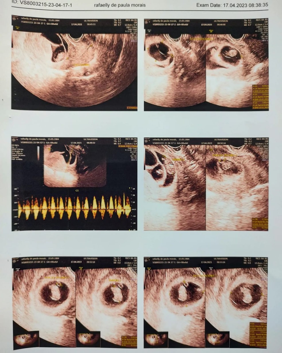 Laudo do especialista em medicina fetal mostra cinco bebês  — Foto: Arquivo pessoal