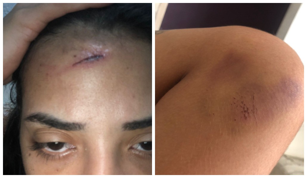 Jovem que esfaqueou namorado em Maceió detalha histórico de agressão e perseguição: 'Ele já me deu paulada'