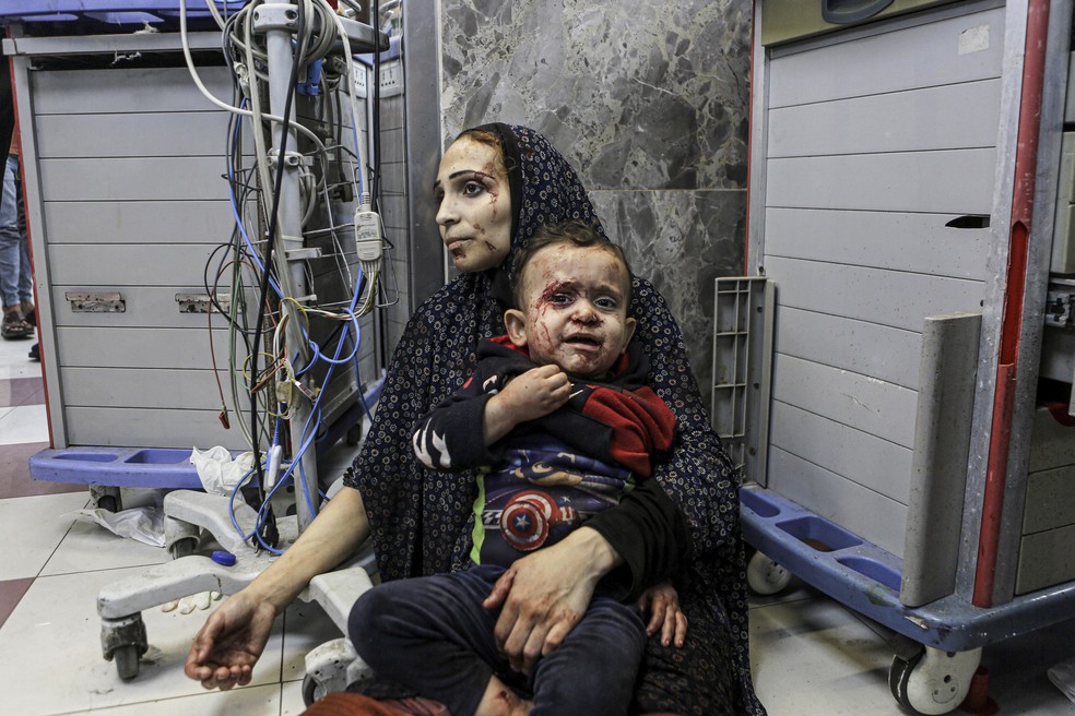 Palestinos feridos aguardam tratamento no hospital al-Shifa, na cidade de Gaza, centro da Faixa de Gaza, ter�a-feira, 17 de outubro de 2023. � Foto: AP Photo/Abed Khaled