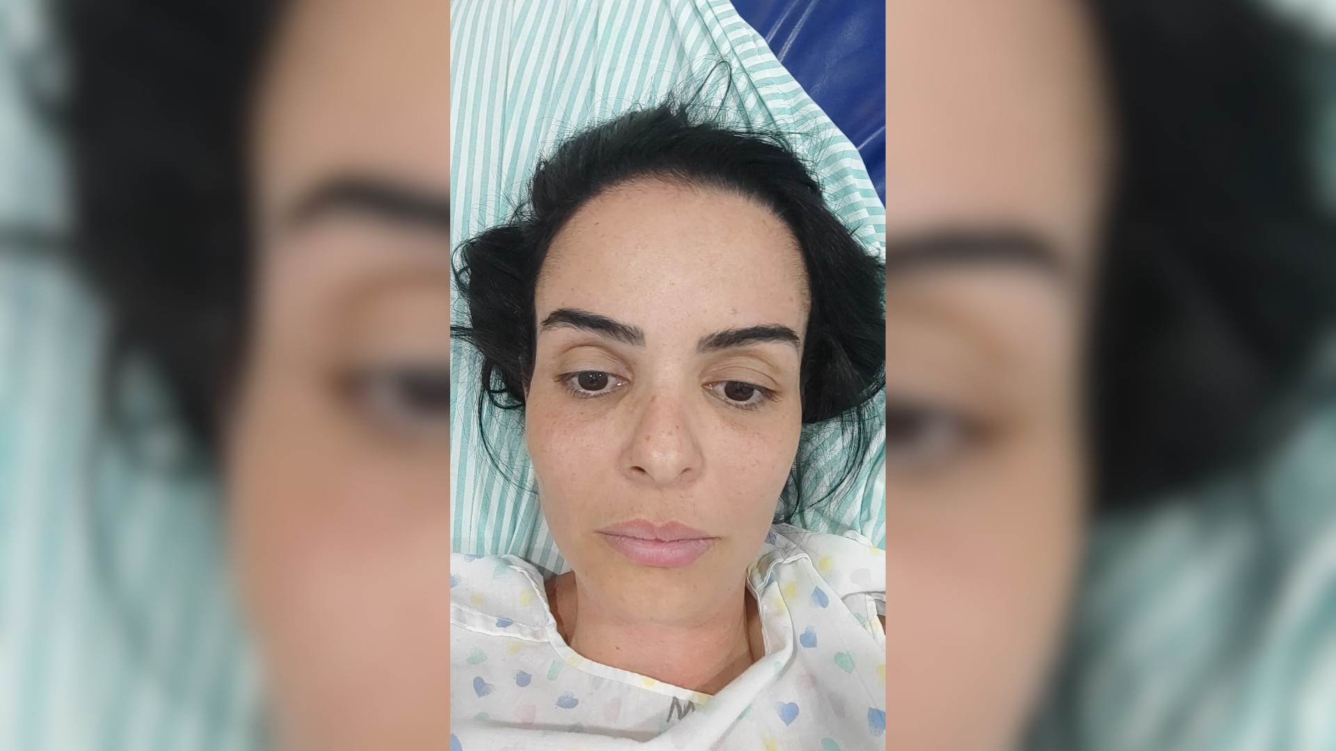 Trabalhadora picada 300 vezes no rosto por abelhas-europeias foi atacada por 40 minutos: 'Nova chance'