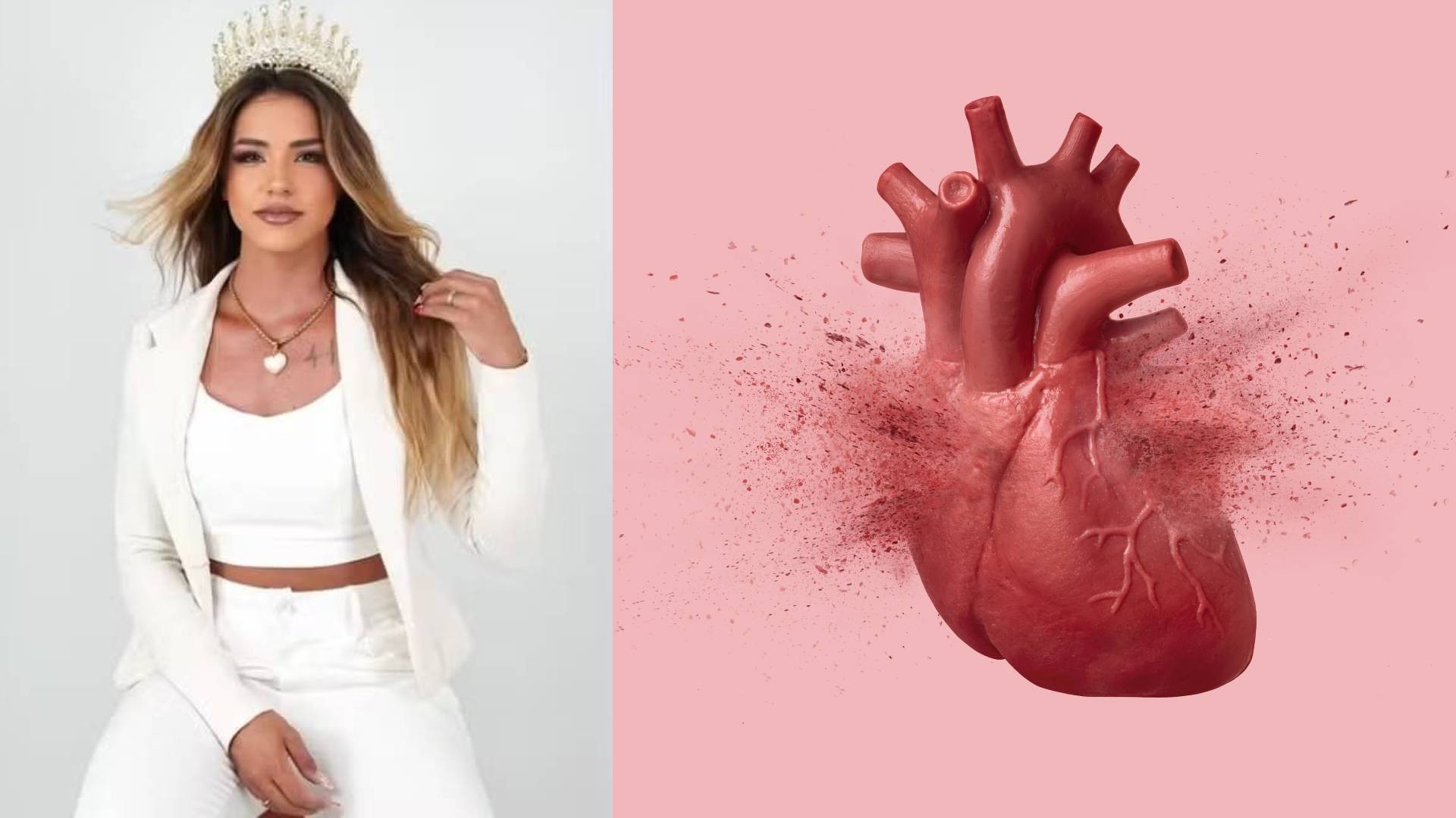 Infarto em miss de 31 anos chama atenção para sintomas e prevenção